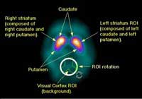 figure2